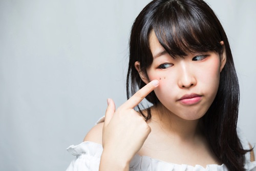 【ほくろ除去の名医】と呼ばれる10人の医師を紹介！国内でも有数の高い技術を持った先生を厳選して紹介