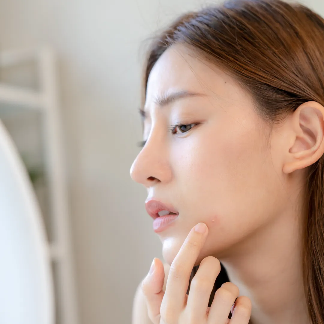 【ニキビ跡治療の名医】と呼ばれる10人の医師！国内でも有数の高い技術を持った先生を厳選して紹介